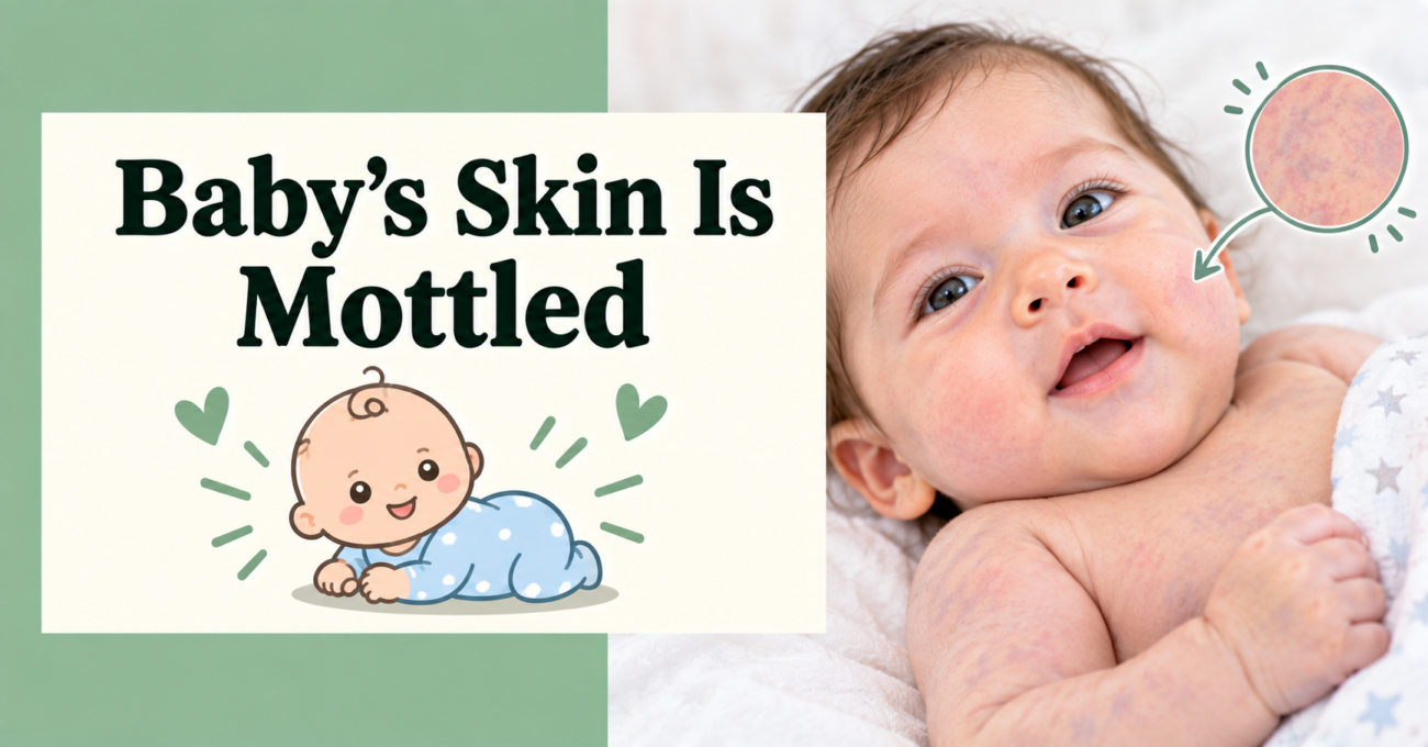 Baby's Skin Is Mottled