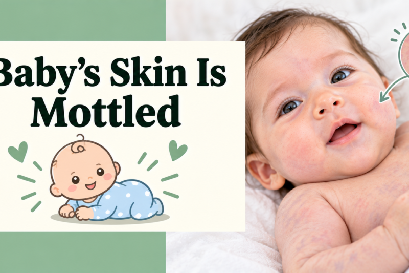 Baby’s Skin Is Mottled: Causes and When to Worry